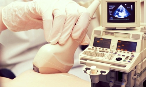 ultrasonido-mamario-checkup