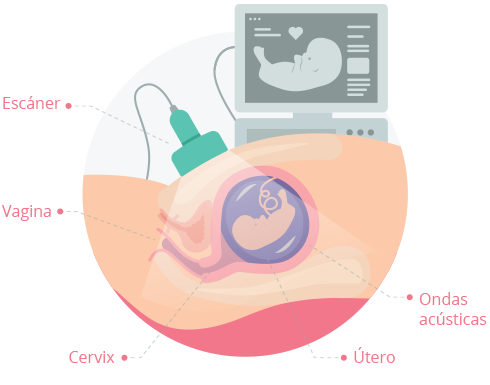ultrasonido-obstetrico-tipos
