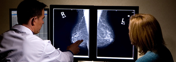 Conoce más sobre el diagnóstico y las etapas del cáncer de mama