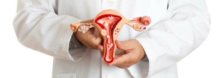 Causas, síntomas, detección y prevención del cáncer cervical